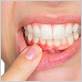 gum disease treatment in buffalo grove