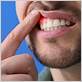 gum disease treatment in encino