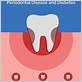 gum disease treatment in monroe