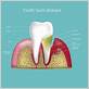 gum disease treatment in phoenix