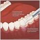 gum disease treatment in ridgecrest