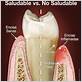 gum disease treatment in spanish