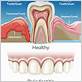 gum disease treatment in sterling