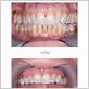 gum disease treatment in tustin