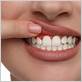 gum disease treatment in vacaville