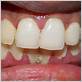 gum disease treatment in vienna