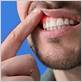 gum disease treatment in woodland