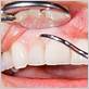 gum disease treatment jackson county