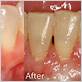 gum disease treatment kansas city mo