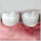 gum disease treatment kentucky