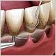 gum disease treatment kerrville tx