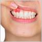 gum disease treatment knoxville