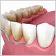 gum disease treatment lancaster