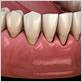gum disease treatment leawood ks
