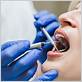 gum disease treatment livermore