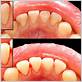 gum disease treatment longview