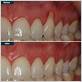 gum disease treatment lower manhattan