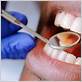 gum disease treatment madison al