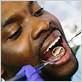 gum disease treatment marion county