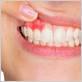 gum disease treatment melbourne cbd