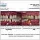 gum disease treatment metairie