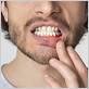 gum disease treatment nashville tn