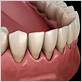 gum disease treatment nebraska