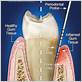 gum disease treatment new deal tn