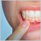 gum disease treatment norridge il