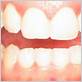 gum disease treatment northbrook il