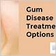 gum disease treatment options chelsea