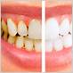 gum disease treatment orlando