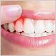 gum disease treatment pheonix az