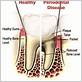 gum disease treatment richmond va