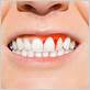 gum disease treatment rocklin