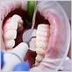 gum disease treatment san leandro