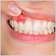 gum disease treatment sandwich ma