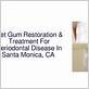 gum disease treatment santa monica