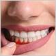 gum disease treatment santa rosa