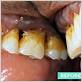 gum disease treatment springfield va