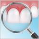 gum disease treatment stafford