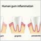 gum disease treatment stockport