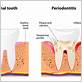 gum disease treatment sutton coldfield