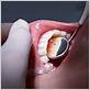 gum disease treatment tullahoma