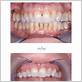 gum disease treatment tustin