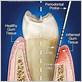 gum disease treatment warren