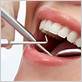 gum disease treatment west end