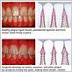 gum disease treatment west virginia