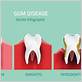 gum disease treatment western springs il