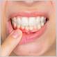 gum disease treatments arlington